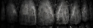 Macro photograph of worn enamel showing surface texture.